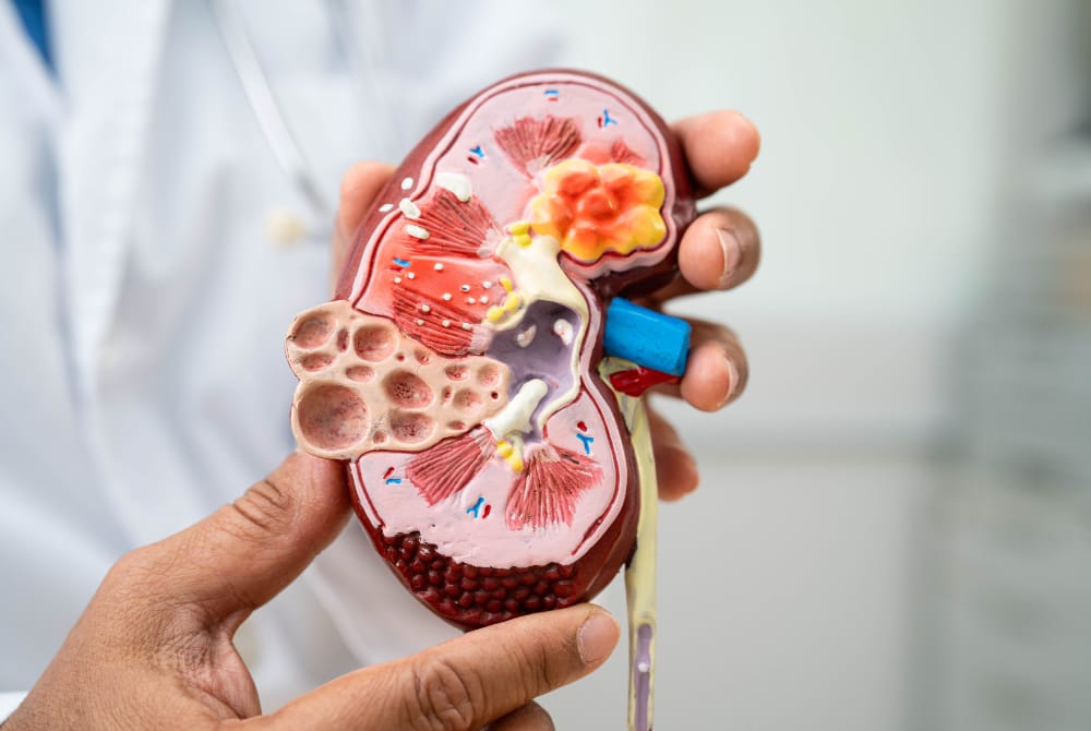Waspada! Selain Diabetes, Ini 7 Penyebab Kerusakan Ginjal yang Sering Tak Disadari